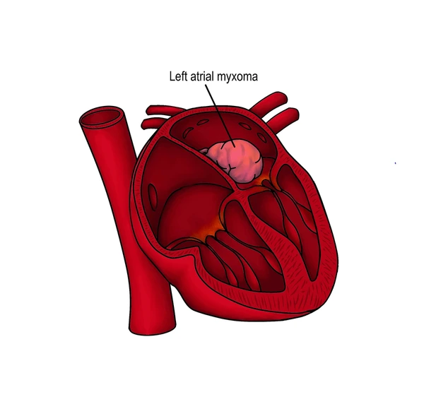 myxoma-disease.webp