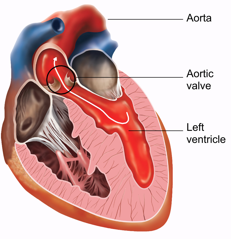 Aortic Valve