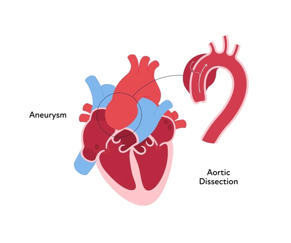 Aortic Root Replacement Surgery