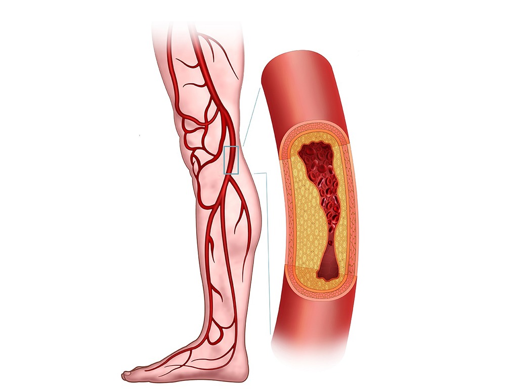 Vascular Surgery