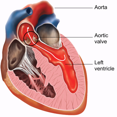 Aortic Valve